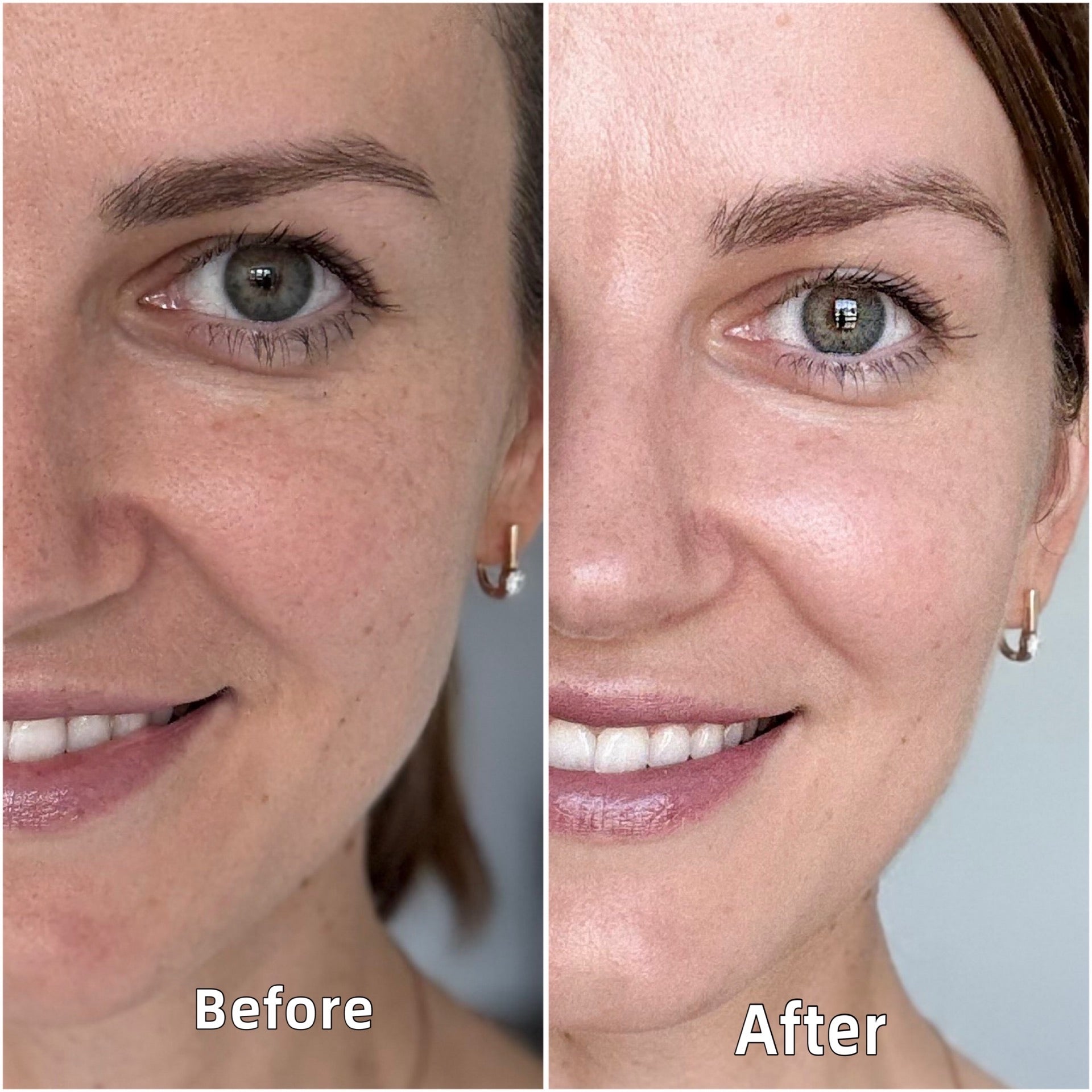 NMN & Peptide Moisturizer Spray