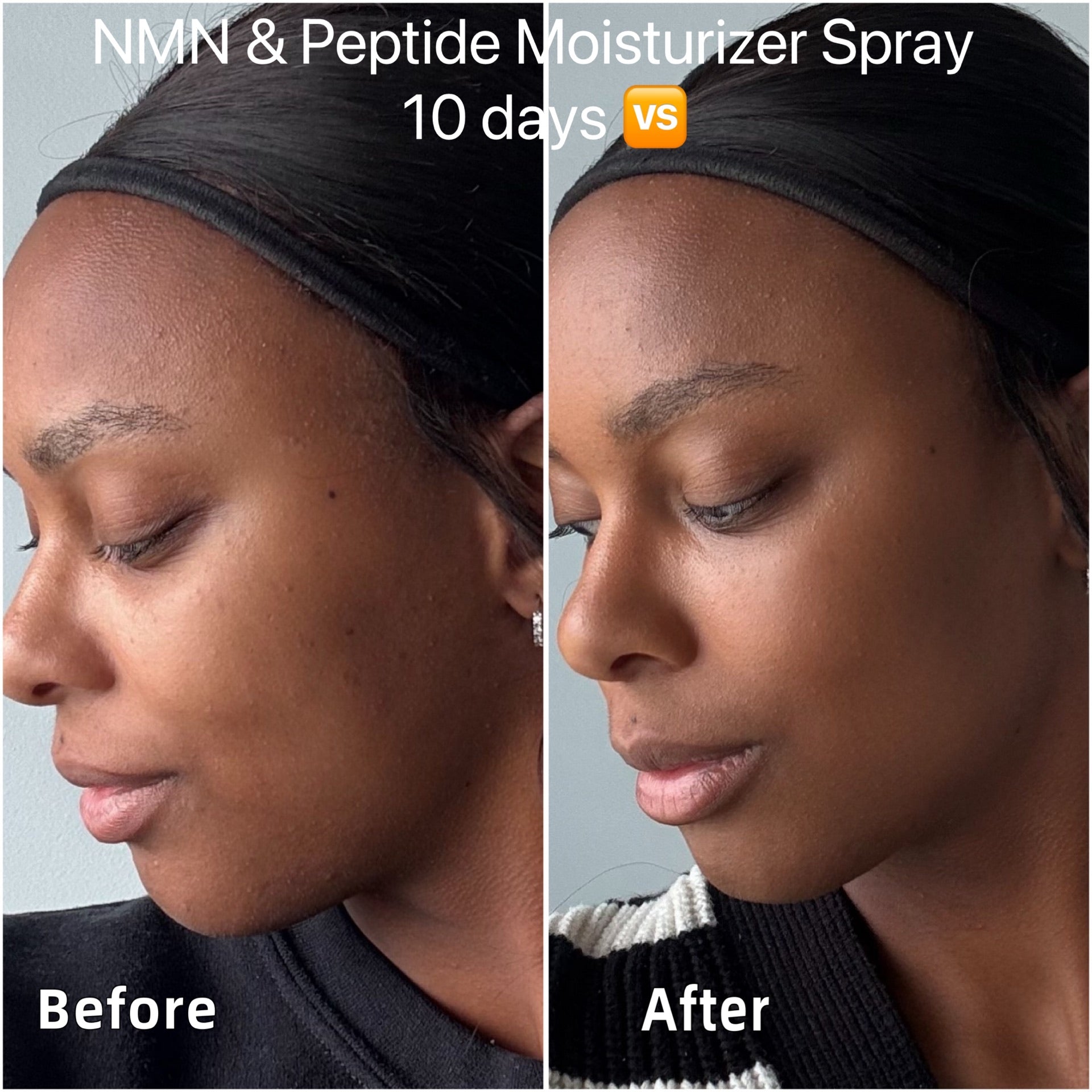 NMN & Peptide Moisturizer Spray — Bundle B (6 Bottles)