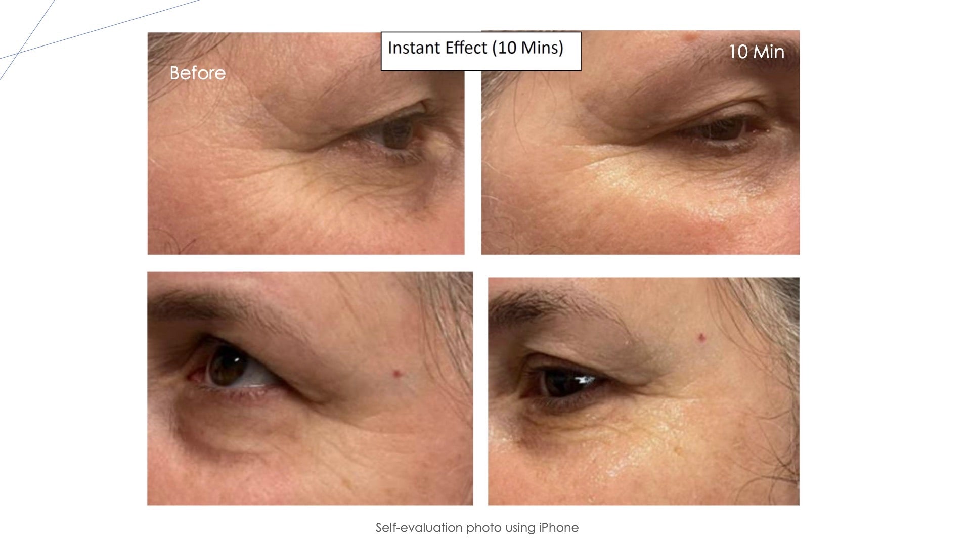 NMN & Peptide Moisturizer Spray